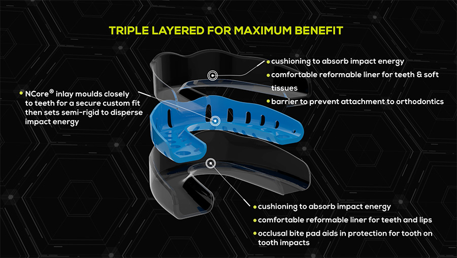 explains the mouthguard technology Neomorph Mouthguards triple-layered benefits
