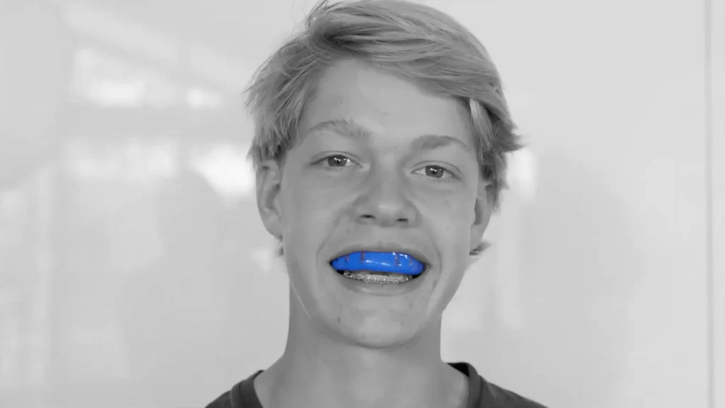 show the mouthguard being worn with braces Neomorph Prodigy re-mouldable sports mouthguard. Mouthguards for Braces.