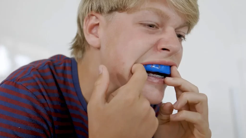 Perfect Mouthguard for Braces and Aligners