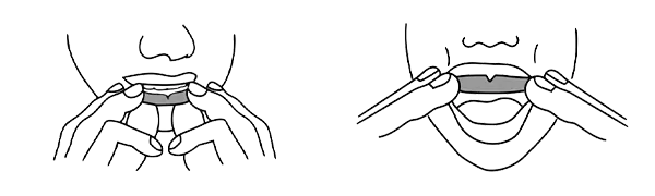 Looking into the mirror, line up the “V’ midline section between your top front teeth and ensure the back ends of your guard are on either side of your back (molar) teeth.