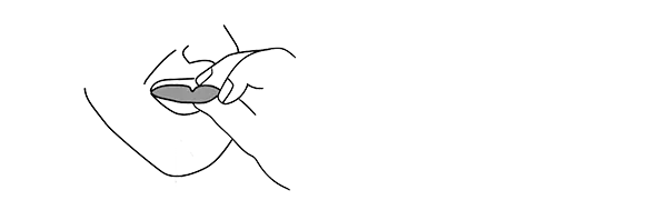 Gently flare the top border of the guard out and pull forward to peel it away from the orthodontic appliances.