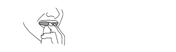 Remove the mouthguard by placing fingers at the top border of the guard and pull the mouth guard directly down.